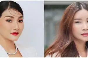 9 Portraits of Sarwendah showing her face after undergoing plastic surgery, netizens say she is more beautiful in the original