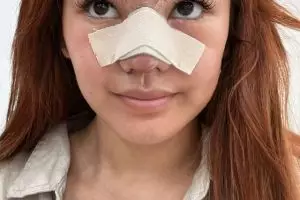 Sudah jadi impiannya sejak SMP, ini 7 potret Shafa Harris jalani oplas hidung di Korea Selatan