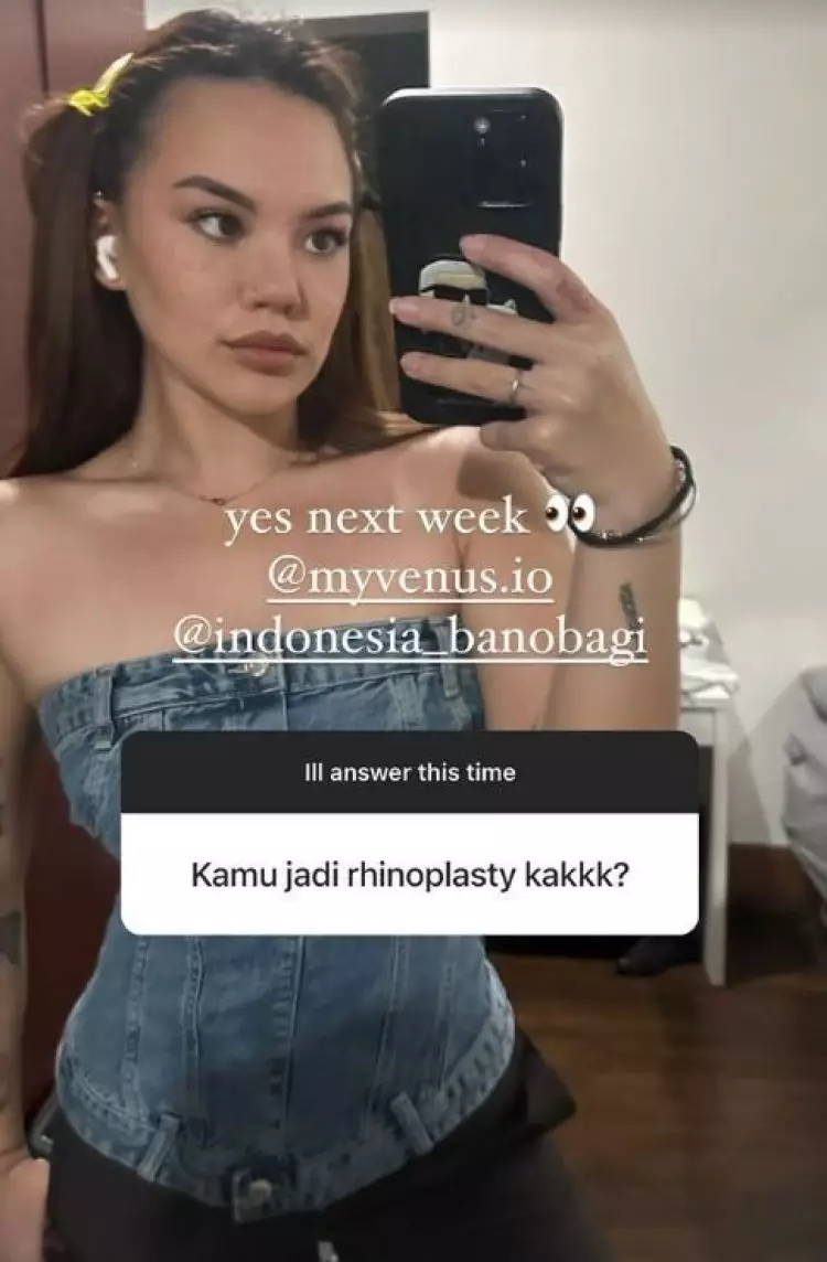 Sudah jadi impiannya sejak SMP, ini 7 potret Shafa Harris jalani oplas hidung di Korea Selatan