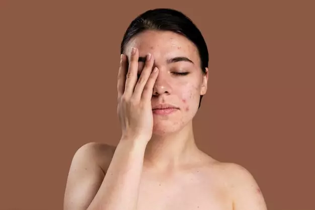 Manfaat serum Wardah untuk jerawat ©  Manfaat serum Wardah untuk jerawat ©