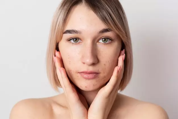 Manfaat serum Wardah untuk jerawat ©  Manfaat serum Wardah untuk jerawat ©