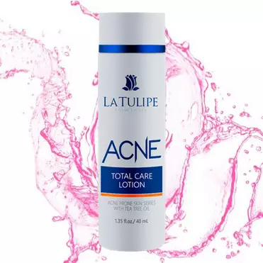 Skincare La Tulipe untuk wajah berjerawat Berbagai sumber  Skincare La Tulipe untuk wajah berjerawat Berbagai sumber