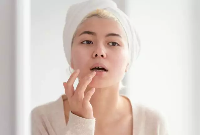 Cara mencegah bibir kering saat berpuasa freepik.com