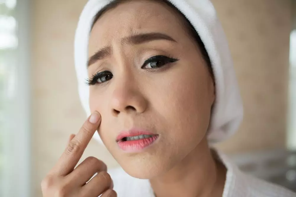 Masalah kulit yang sering dialami selama puasa © Masalah kulit yang sering dialami selama puasa ©