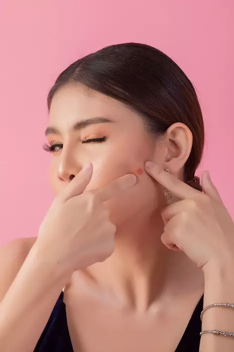 Tahapan skincare pagi kulit berjerawat Berbagai sumber