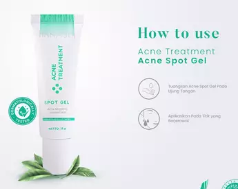  Acne Spot Gel atasi wajah berjerawat Berbagai sumber