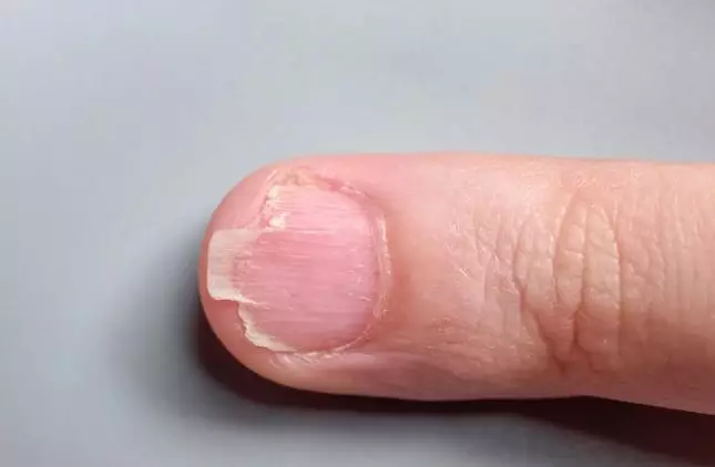 Cara merawat kuku tampak berkilau & sehat freepik.com Cara merawat kuku tampak berkilau & sehat freepik.com