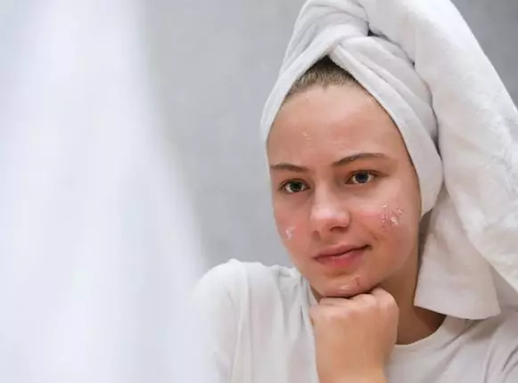 Perawatan wajah atasi jerawat ala Astrid Tiar Berbagai sumber