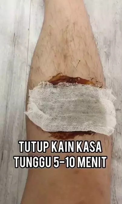 Cara membuat waxing gel alami cuma pakai 2 bahan dapur Berbagai sumber