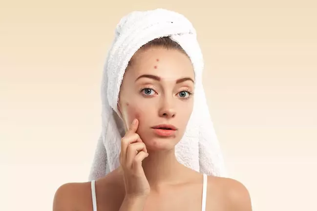 cara memilih kandungan acne spot treatment sesuai jenis jerawat berbagai sumber