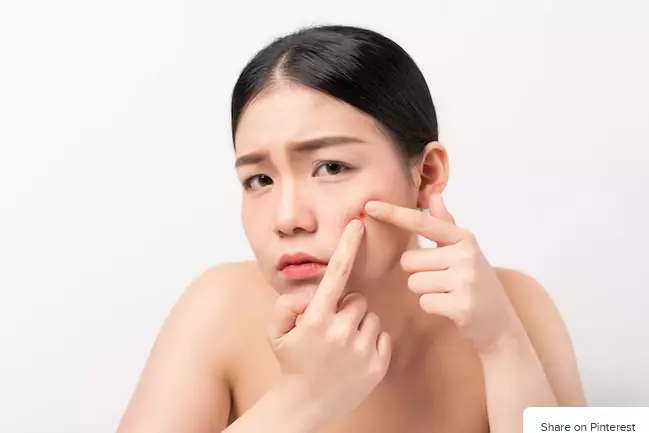 cara memilih kandungan acne spot treatment sesuai jenis jerawat berbagai sumber