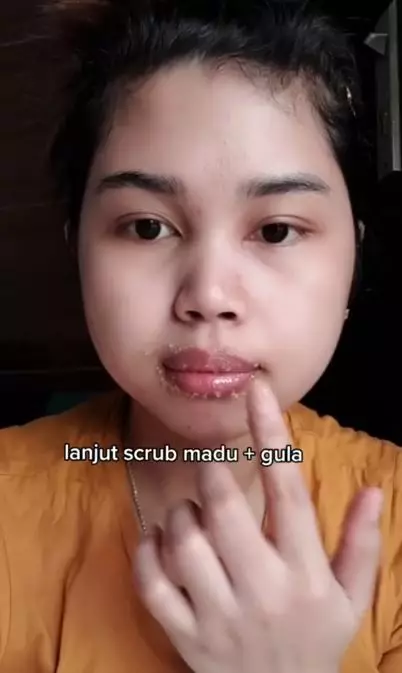 Cara mengatasi bibir hitam dan mengelupas pakai 3 bahan dapur Berbagai sumber Cara mengatasi bibir hitam dan mengelupas pakai 3 bahan dapur Berbagai sumber