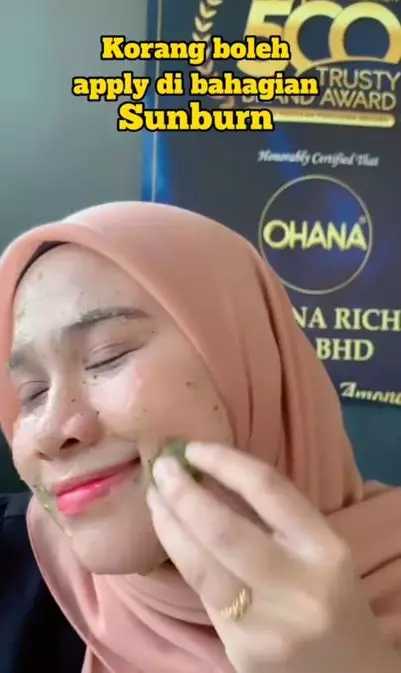 Cara mengatasi kemerahan akibat sinar matahari pakai 2 bahan dapur Berbagai sumber