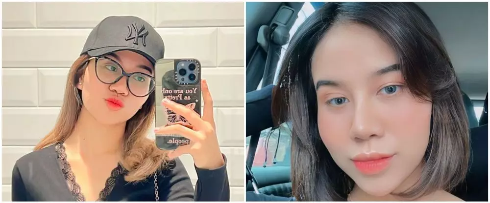 penampilan penyanyi sebelum dan sesudah operasi © berbagai sumber