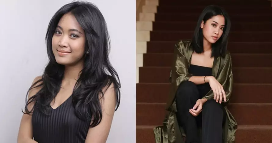 penampilan penyanyi sebelum dan sesudah operasi © berbagai sumber