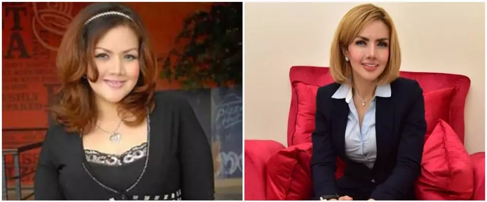 penampilan penyanyi sebelum dan sesudah operasi © berbagai sumber