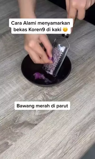 Cara menyamarkan bekas koreng pada kaki pakai 2 bahan dapur Berbagai sumber Cara menyamarkan bekas koreng pada kaki pakai 2 bahan dapur Berbagai sumber