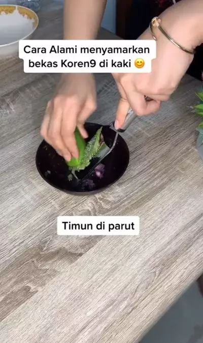 Cara menyamarkan bekas koreng pada kaki pakai 2 bahan dapur Berbagai sumber Cara menyamarkan bekas koreng pada kaki pakai 2 bahan dapur Berbagai sumber