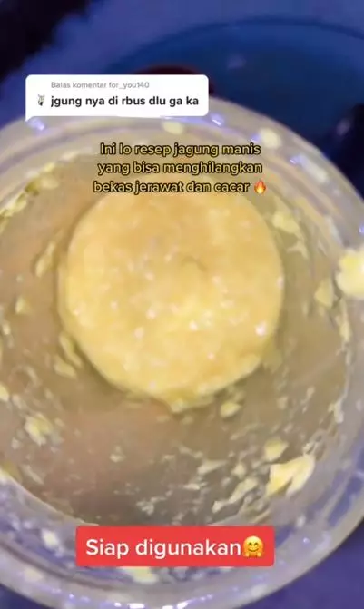 Trik menghilangkan bekas cacar pakai 2 bahan alami Berbagai sumber Trik menghilangkan bekas cacar pakai 2 bahan alami Berbagai sumber