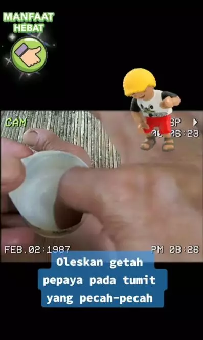 Cara haluskan tumit yang pecah-pecah pakai 1 jenis buah Berbagai sumber Cara haluskan tumit yang pecah-pecah pakai 1 jenis buah Berbagai sumber