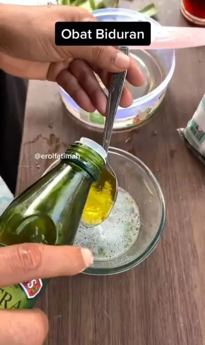 Cara atasi biduran secara alami pakai 3 bahan dapur Berbagai sumber Cara atasi biduran secara alami pakai 3 bahan dapur Berbagai sumber