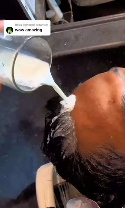 Trik menghilangkan ketombe pada pria pakai 1 bahan dapur Berbagai sumber Trik menghilangkan ketombe pada pria pakai 1 bahan dapur Berbagai sumber