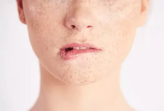 Manfaat mengikuti step skincare rutin ala Korea © 2023 brilio.net