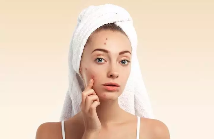 tanda skincare tidak cocok bagi kulit berbagai sumber tanda skincare tidak cocok bagi kulit berbagai sumber