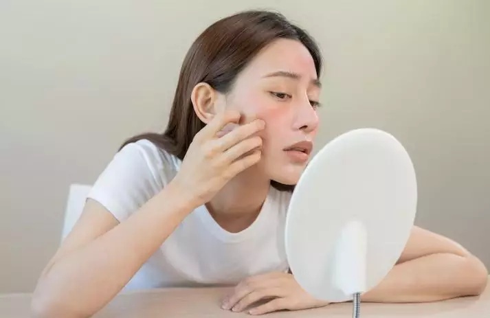 tanda skincare tidak cocok bagi kulit berbagai sumber tanda skincare tidak cocok bagi kulit berbagai sumber