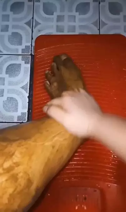 Cara atasi hiperpigmentasi tangan dan kaki pakai 4 bahan dapur Berbagai sumber Cara atasi hiperpigmentasi tangan dan kaki pakai 4 bahan dapur Berbagai sumber