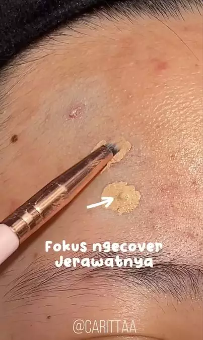 Trik samarkan jerawat matang menggunakan 2 produk makeup Berbagai sumber