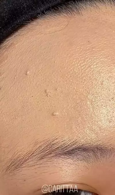 Trik samarkan jerawat matang menggunakan 2 produk makeup Berbagai sumber