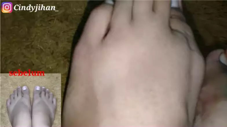 cara mengatasi kaki belang berbagai sumber cara mengatasi kaki belang berbagai sumber