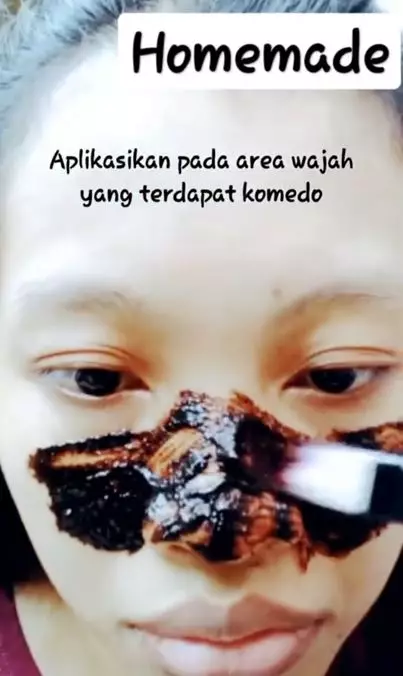 Trik hilangkan komedo pakai pore pack dari 2 bahan dapur Berbagai sumber Trik hilangkan komedo pakai pore pack dari 2 bahan dapur Berbagai sumber