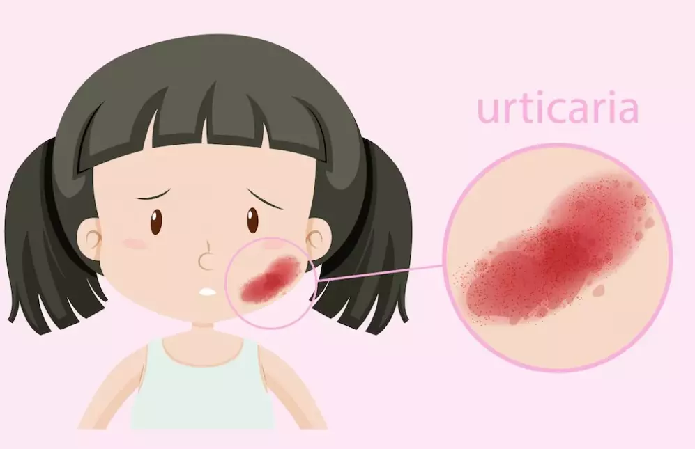 efek samping penggunaan baking soda pada kulit © 2023 berbagai sumber efek samping penggunaan baking soda pada kulit © 2023 berbagai sumber