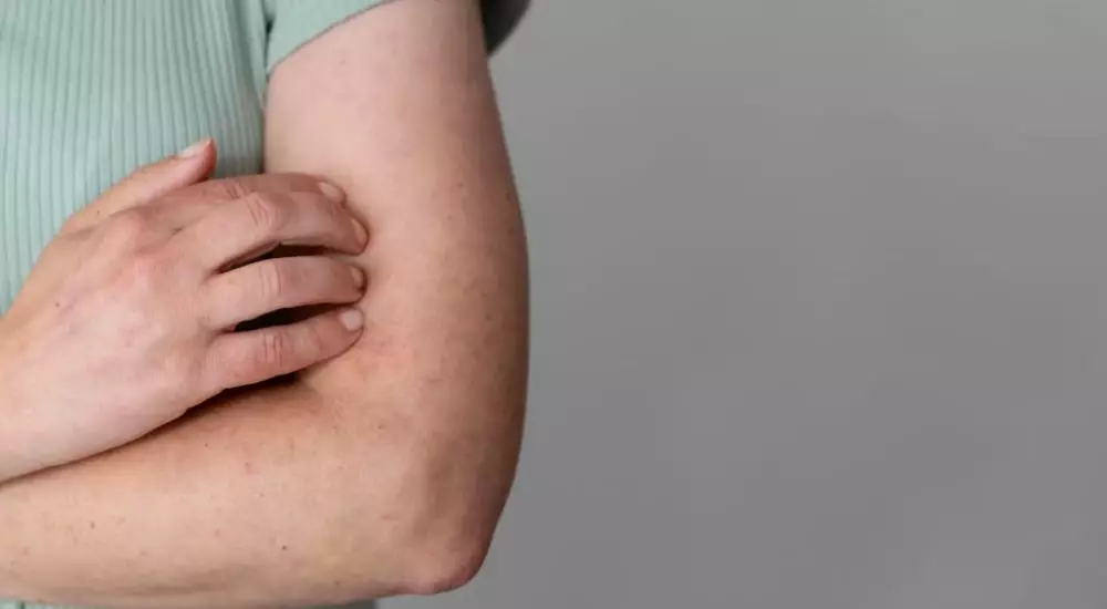 efek samping penggunaan baking soda pada kulit © 2023 berbagai sumber efek samping penggunaan baking soda pada kulit © 2023 berbagai sumber