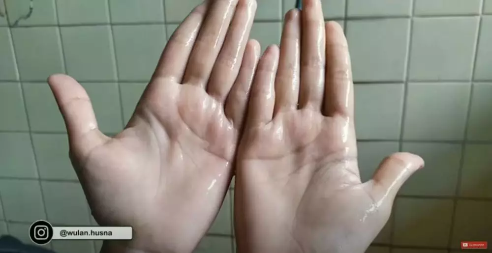 cara mudah atasi kapalan pada tangan berbagai sumber cara mudah atasi kapalan pada tangan berbagai sumber