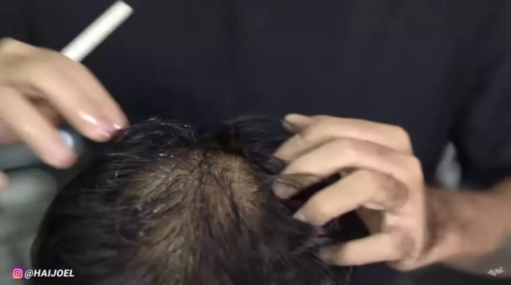 cara mudah menebalkan rambut botak M berbagai sumber