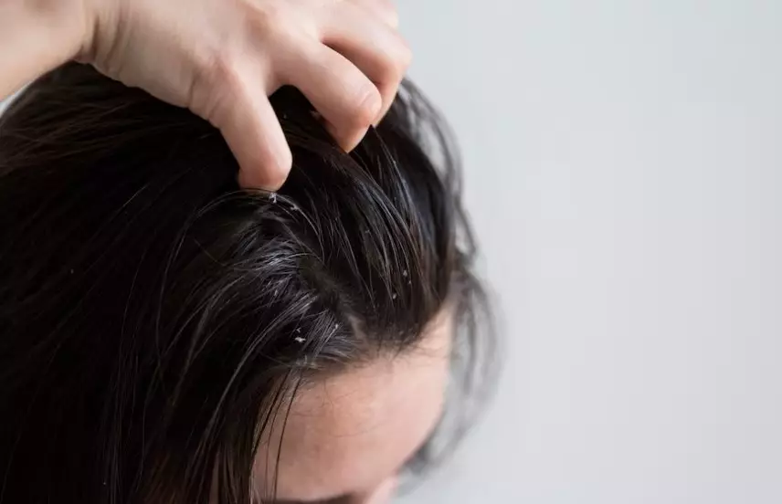 Manfaat rutin pakai vitamin rambut Istimewa