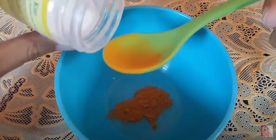 trik memutihkan gigi agar tampak cerah bersinar berbagai sumber trik memutihkan gigi agar tampak cerah bersinar berbagai sumber