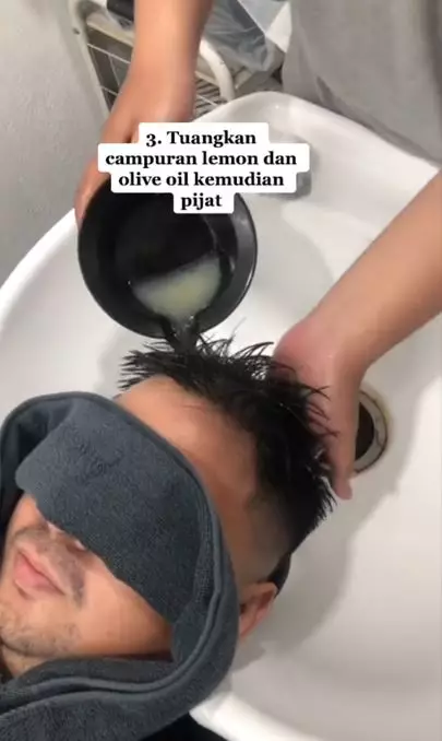 Cara mengatasi ketombe pria ala rumahan pakai 2 bahan dapur Berbagai sumber Cara mengatasi ketombe pria ala rumahan pakai 2 bahan dapur Berbagai sumber