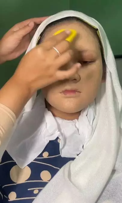 Trik bikin riasan flawless pada wajah bertekstur dengan 2 alat Berbagai sumber Trik bikin riasan flawless pada wajah bertekstur dengan 2 alat Berbagai sumber