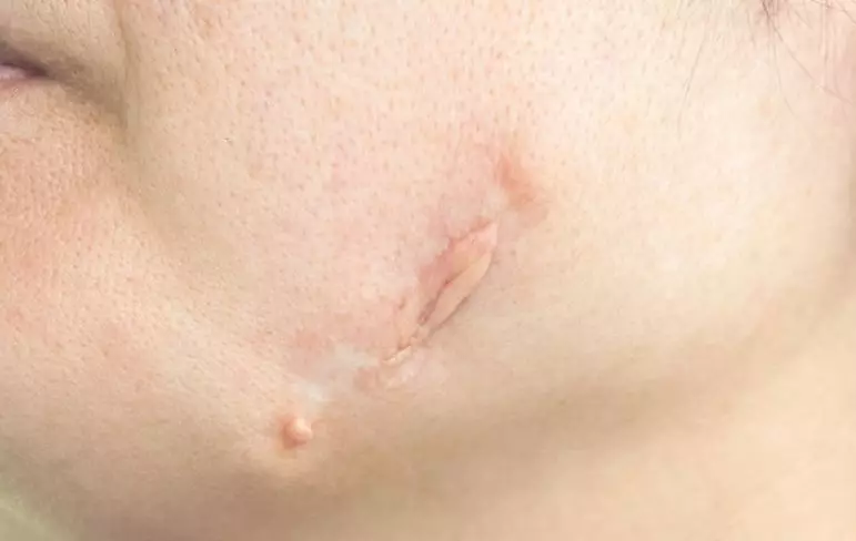 Manfaat cengkeh untuk kecantikan wajah © 2023 berbagai sumber Manfaat cengkeh untuk kecantikan wajah © 2023 berbagai sumber