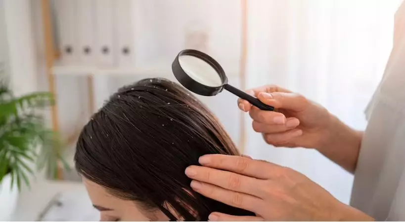 kelebihan pakai alpukat untuk kesehatan rambut © 2023 brilio.net