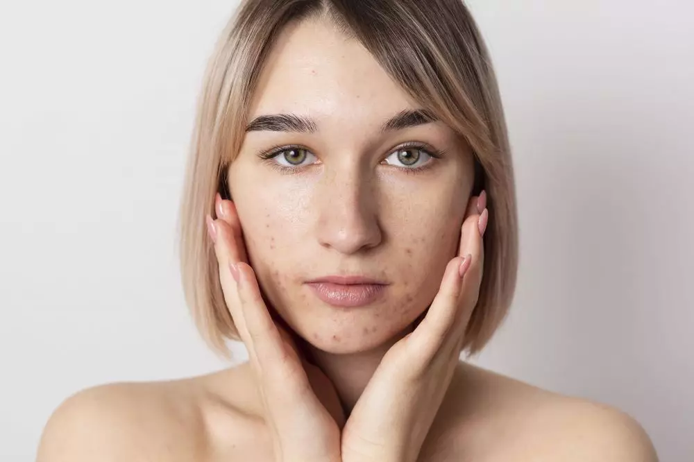 Bahaya penggunaan merkuri © berbagai sumber Bahaya penggunaan merkuri © berbagai sumber