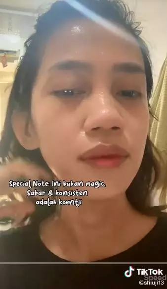  cara melakukan facial steam yang benar berbagai sumber