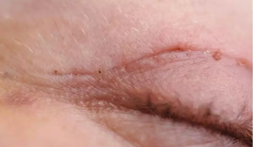 7 Kelebihan pakai jojoba oil © freepik.com