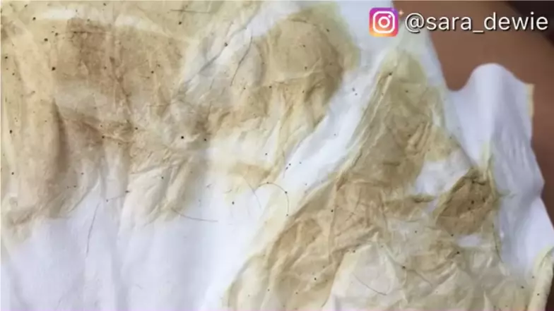 cara mudah hilangkan bulu kaki berbagai sumber