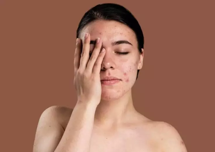 manfaat teh chamomile untuk wajah © berbagai sumber manfaat teh chamomile untuk wajah © berbagai sumber