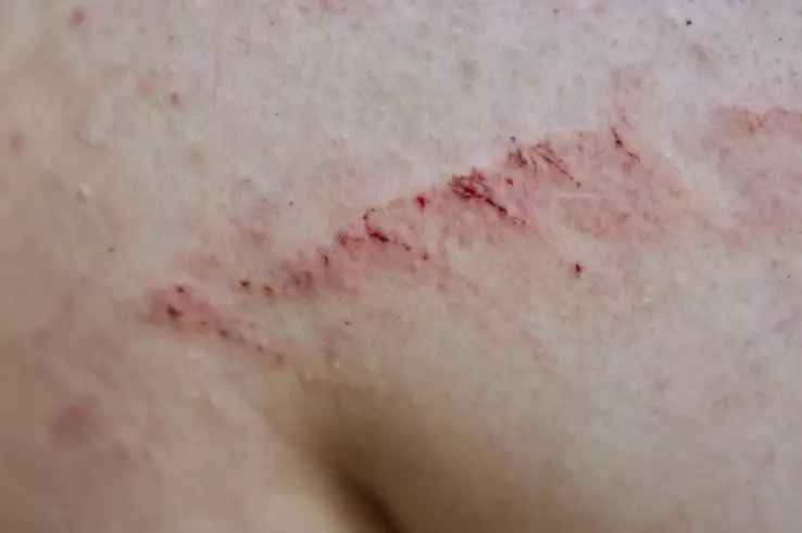 manfaat teh chamomile untuk wajah © berbagai sumber manfaat teh chamomile untuk wajah © berbagai sumber